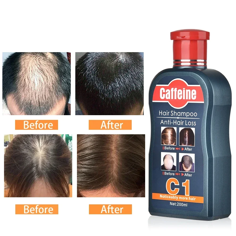 Sampo untuk pertumbuhan rambut - Hair Care Korean Products ulasan dan harga
